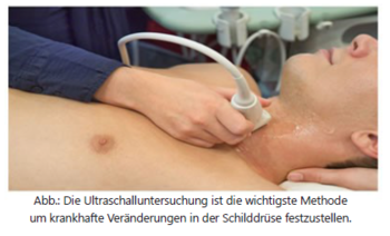 M_Schilddruese_Untersuchung_Ultraschall.PNG